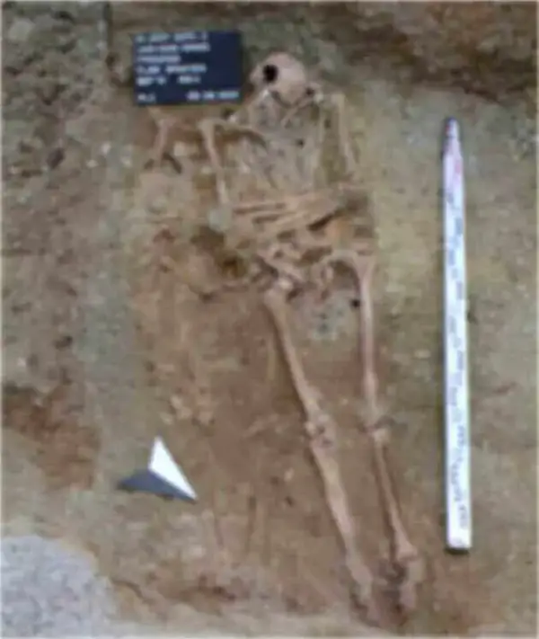 O esqueleto com a prótese de ferro na sepultura.