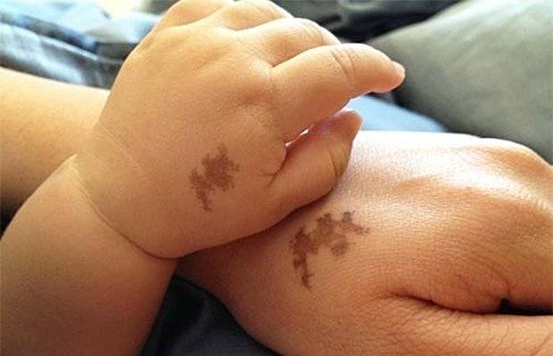 Marcas de nascença na forma de um animal.