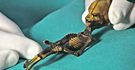 Médico descobre um misterioso corpo alienígena de 18 cm no Chile