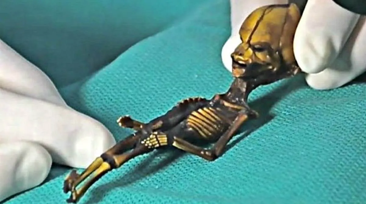 Médico descobre um misterioso corpo alienígena de 18 cm no Chile