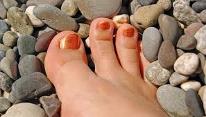 as descobertas de pés desmembrados no Mar Salish