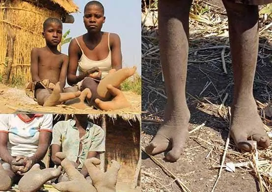 A misteriosa tribo Vadoma com pés de avestruz