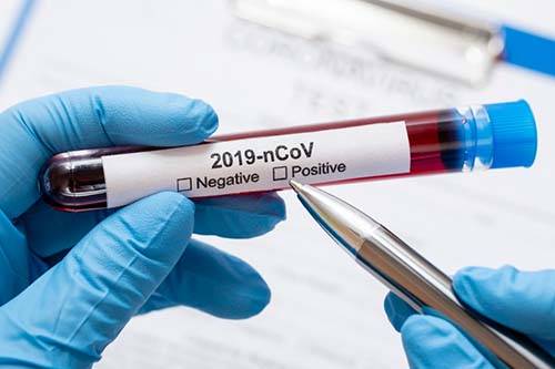 O 'Washington Post' mostra que o coronavírus emergiu de um laboratório em Wuhan