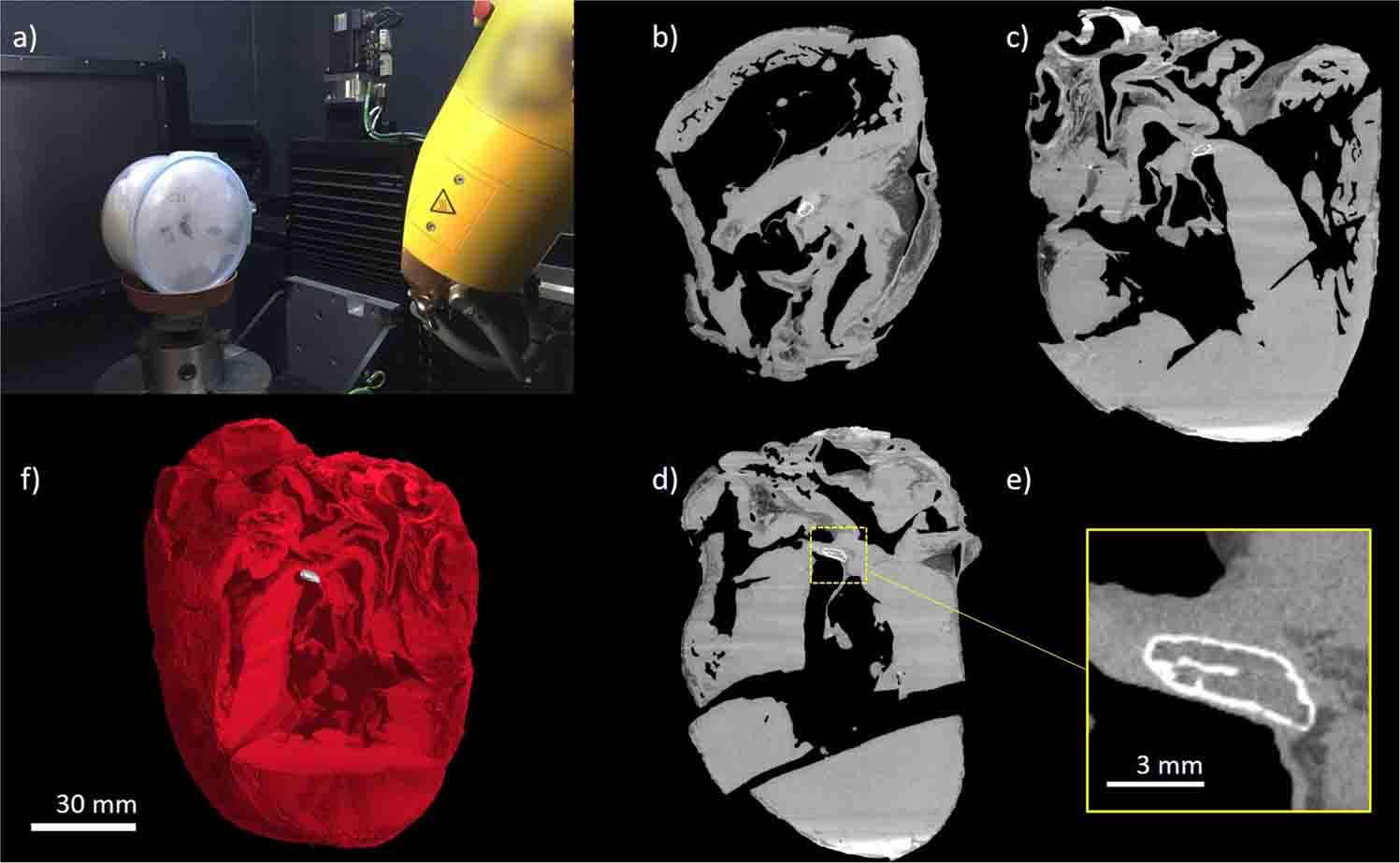 Um misterioso 'osso' é descoberto dentro dos corações de alguns chimpanzés