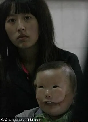 Yi Lianxi contou que foi submetida a três ultrassons comuns e a um com Doppler durante a gravidez, porém nenhuma deformação foi detectada.
