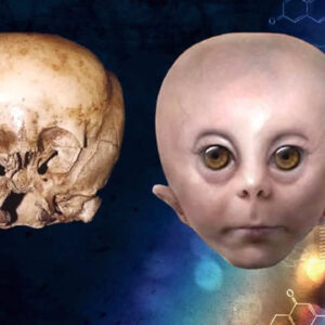 A misteriosa história por trás do StarChild Skull