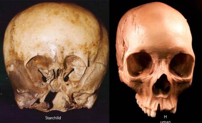 Comparação entre os Crânios