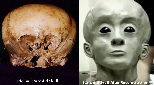 Crânio Starchild Skull original e uma reconstituição de como seria uma criança StarChild
