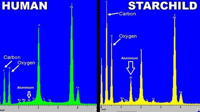 Elementos químicos detectados nos dois crânios por testes espectrométricos.