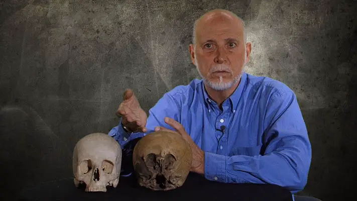 Lloyd Pye mostrando a comparação entre um crânio de uma criança humana e uma StarChild.