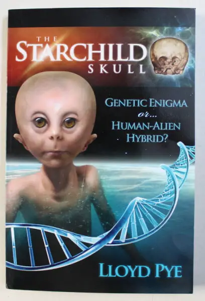 O crânio de Starchild - enigma genético ou... humano - alien híbrido? por Lloyd Pye