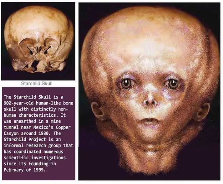 Crânio original e uma reconstituição de como seria uma criança StarChild