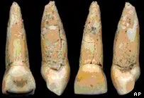 Dentes parecem com os do homem de Neanderthal