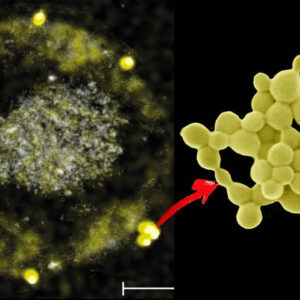 A incrível bactéria que “come” metais pesados ​​e expele ouro