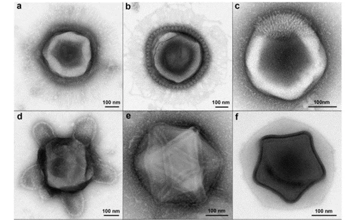 Partículas gigantes semelhantes a vírus nomeadas por suas características estruturais únicas a) semelhante a Mimi b) supernova - c) corte de cabelo - d) tartaruga - e) encanador - f) estrela de Natal.