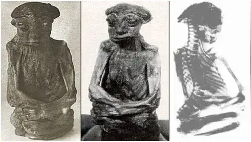 Fotos e raio-x da Múmia de São Pedro.