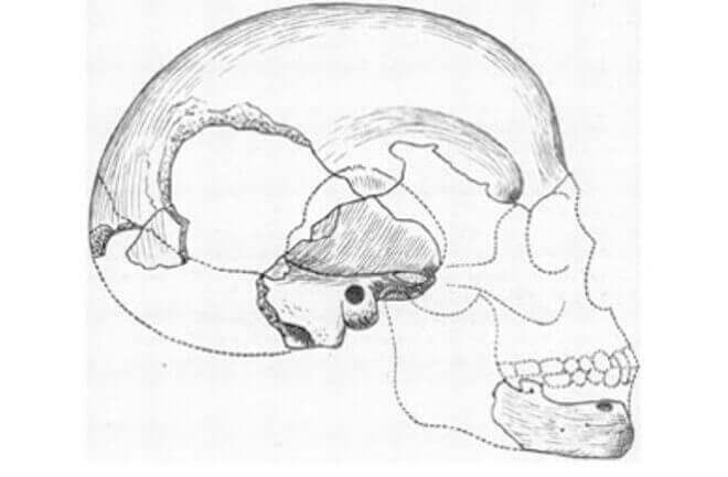 Uma reconstrução esboçada do crânio de Boskop feita em 1918. As áreas sombreadas representam osso recuperado.